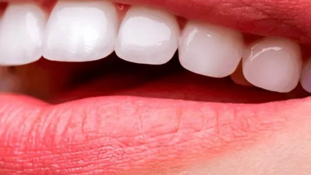 smile-white-qvx59hdncgjpayara3x4itumkmzodz7h13atv962vq.jpg