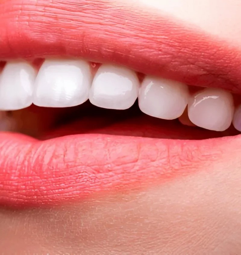 smile-white-qvx59hdncgjpayara3x4itumkmzodz7h13atv962vq.jpg